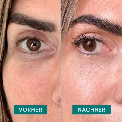 APRICOT silikoonist kortsuplaastrid hüaluroonhappega silmaümbrusele ja meelekohtadesse "Eye Love It", 30x korduvkasutatav - Image 3