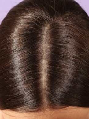 Rosinii Scalp Expert söepulbri ja teepuuõliga peanaha koorija 100ml - Image 3
