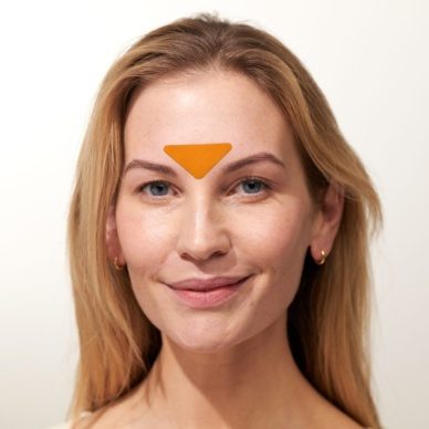 APRICOT kortsuplaastrid niatsiinamiidiga laubale ja silmade vahelisele alale 100tk - Image 2