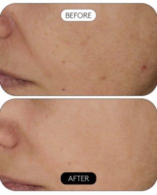 Cocunat Clinical Beauty Filler intensiivhooldus 5ml - Image 2
