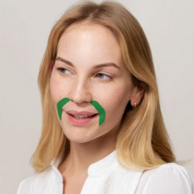 APRICOT kortsuplaastrid aloe veraga suuümbruse naerukortsudele 100tk - Image 2
